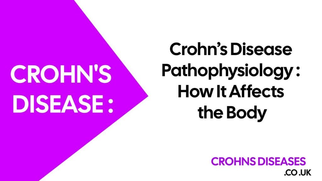 Crohn’s Disease Pathophysiology: How It Affects the Body