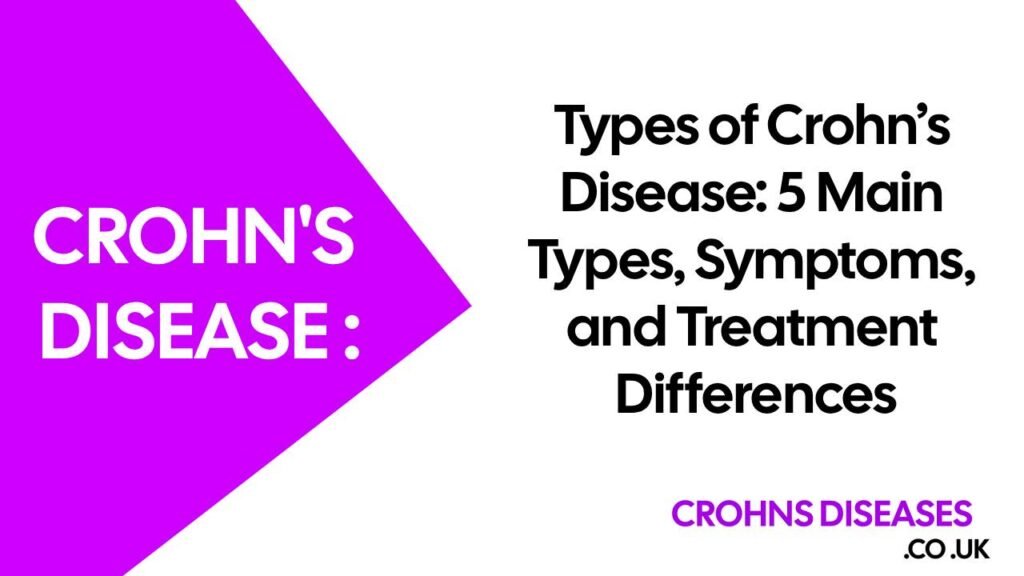 Types of Crohn’s Disease: 5 Main Types, Symptoms, and Treatment Differences