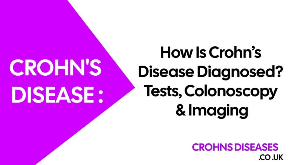 How Is Crohn’s Disease Diagnosed? Tests, Colonoscopy & Imaging