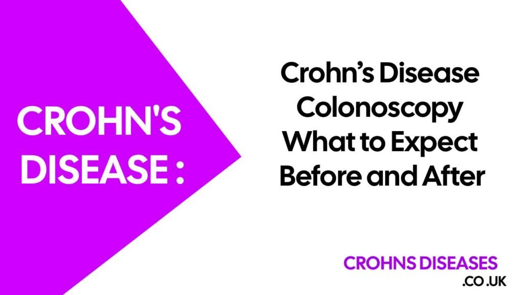 Crohn’s Disease Colonoscopy: What to Expect Before and After