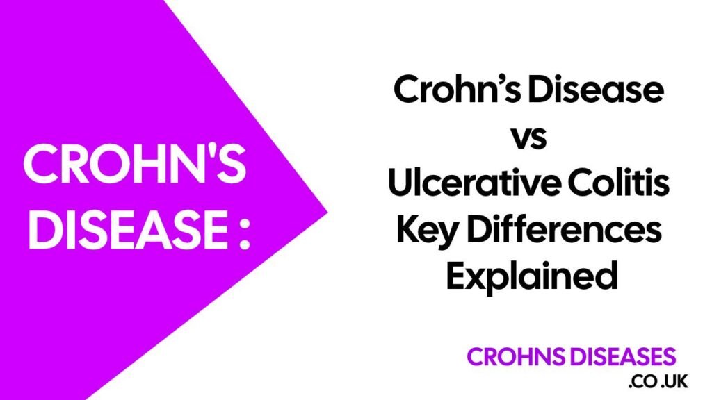 Crohn’s Disease vs Ulcerative Colitis: Key Differences Explained